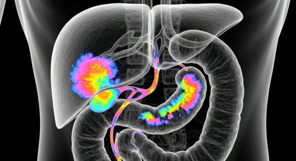 איך מתכוננים לבדיקה בטכנולוגית PET CT